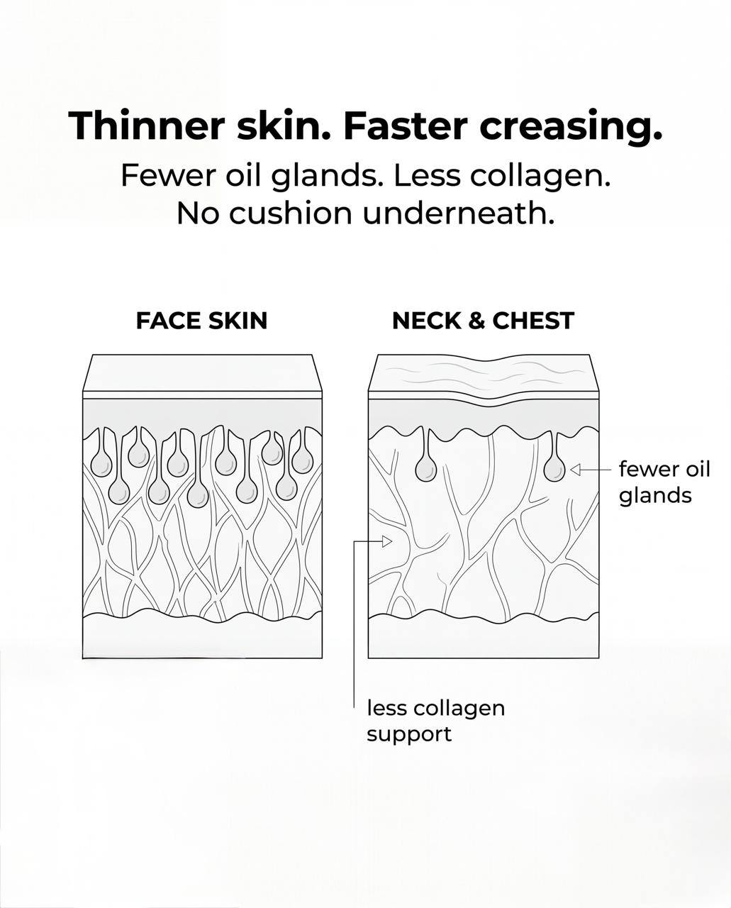 Diagram comparing face skin with thinner neck and chest skin