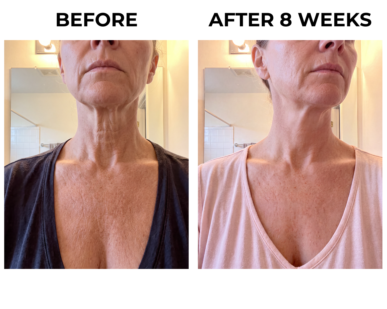 Before and after eight weeks on the neck and chest